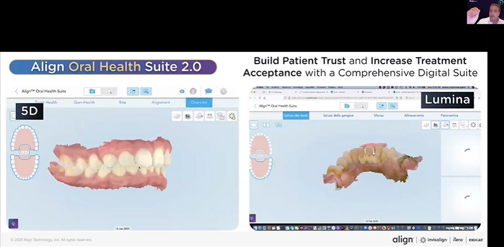 How the use of an intraoral digital scanner can create efficient ...