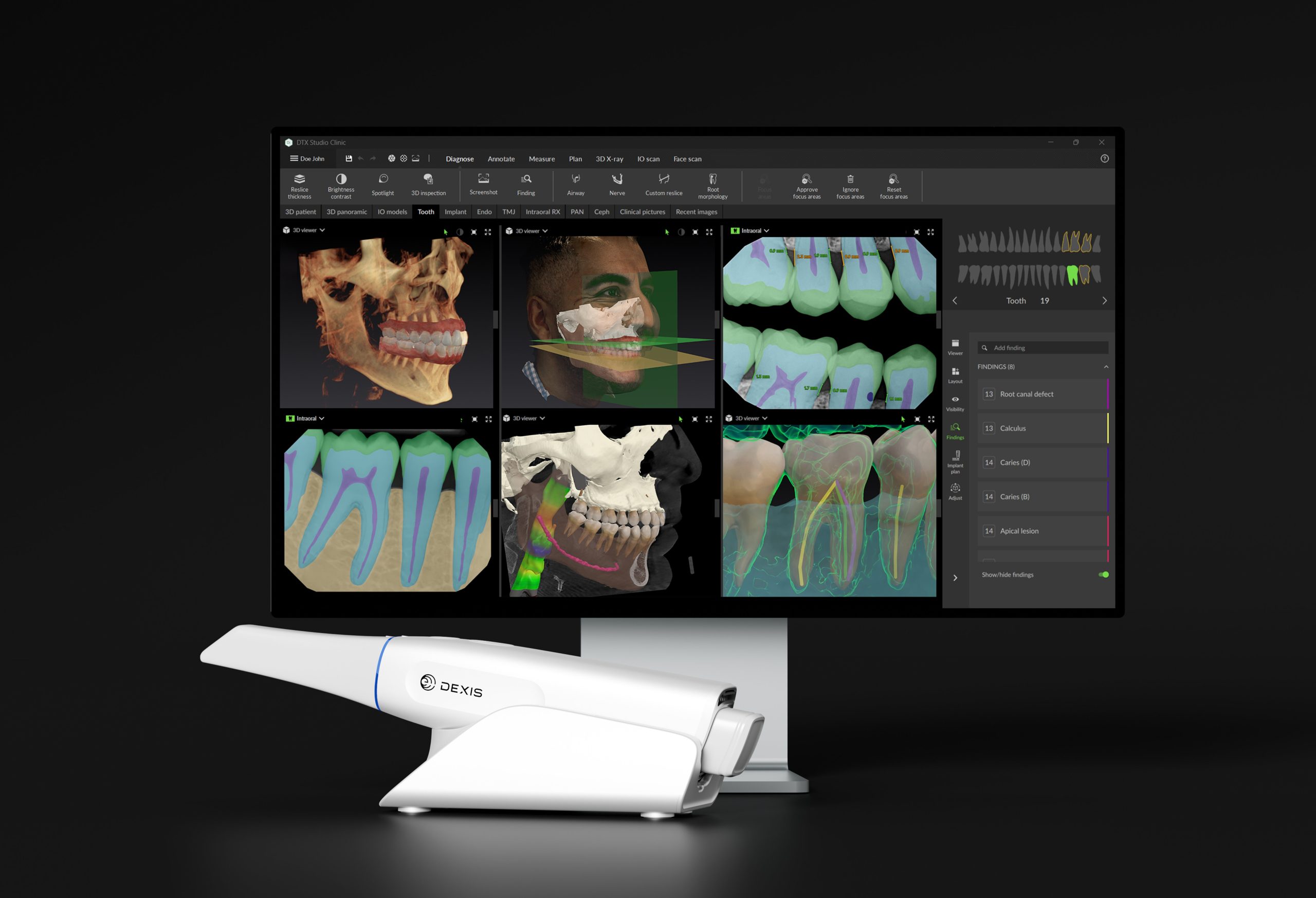 Fig. 1 DTX Studio™ Clinic and DEXIS™ Imprevo