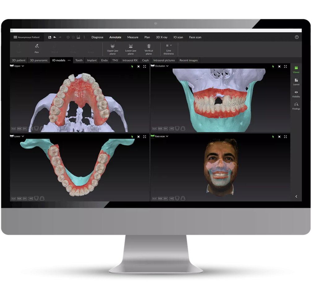 Fig. 2 DTX Studio™ Clinic - Comprehensive patient view