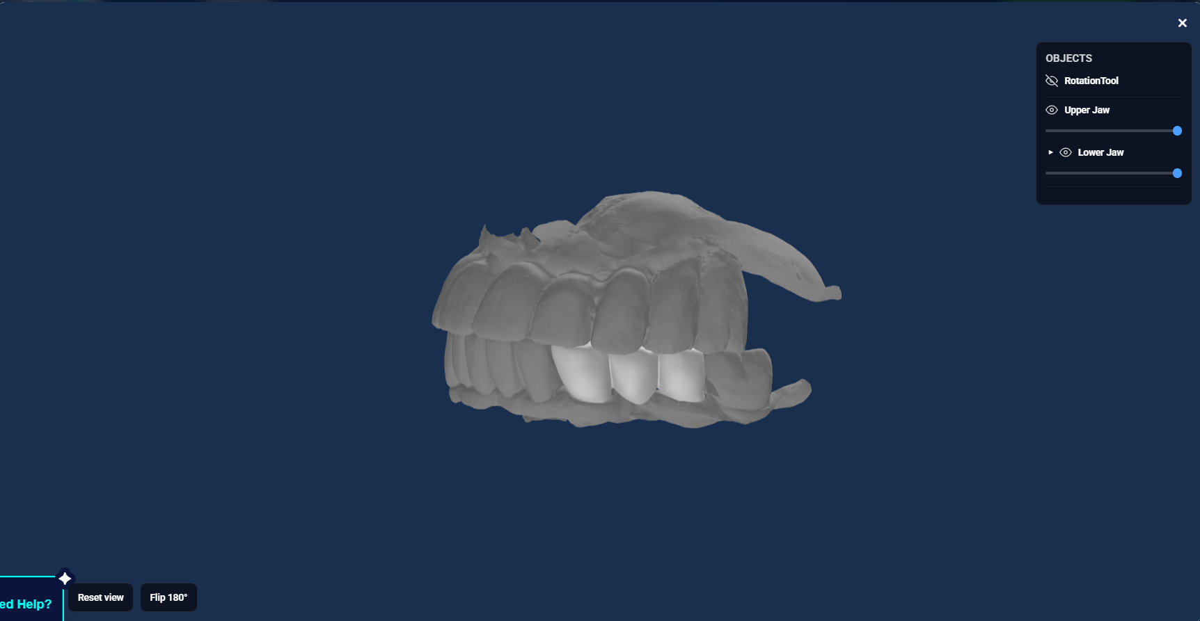 FIG. 8 Browser-based 3D preview for reviewing the designed restoration before download