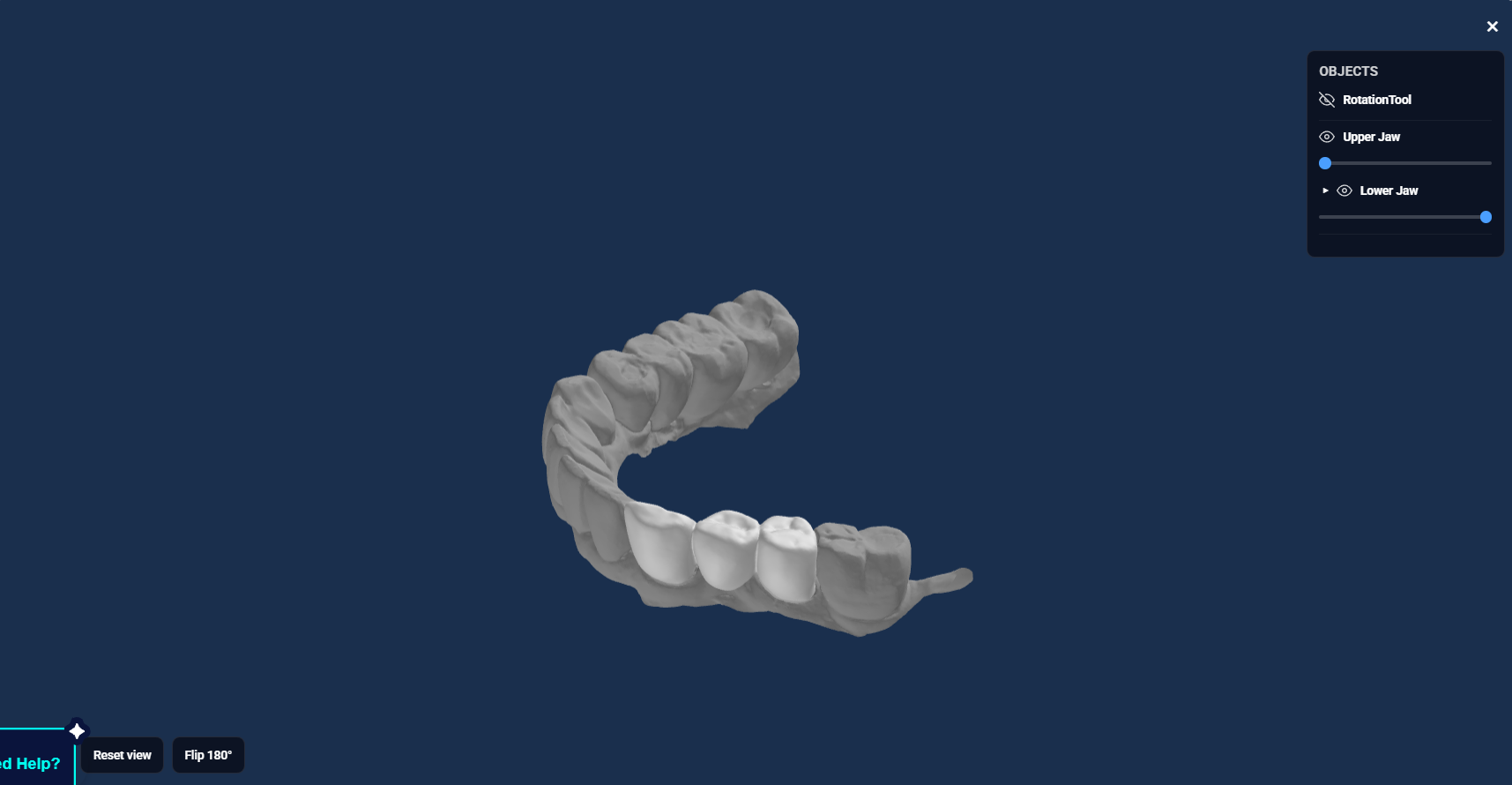 FIG. 7 Browser-based 3D preview for reviewing the designed restoration before download